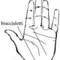 braccialetti